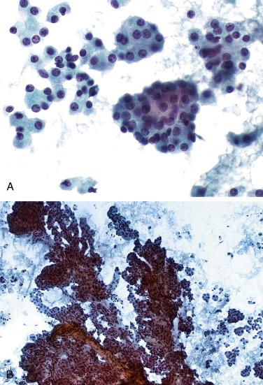 Fig. 14.2, Normal Pancreatic Acinar Cells.