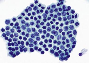 Fig. 14.3, Normal Pancreatic Ductal Cells.