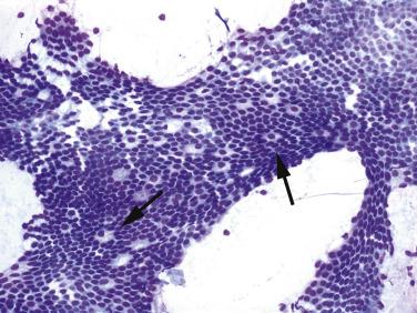 Fig. 14.4, Duodenal Epithelial Cells.