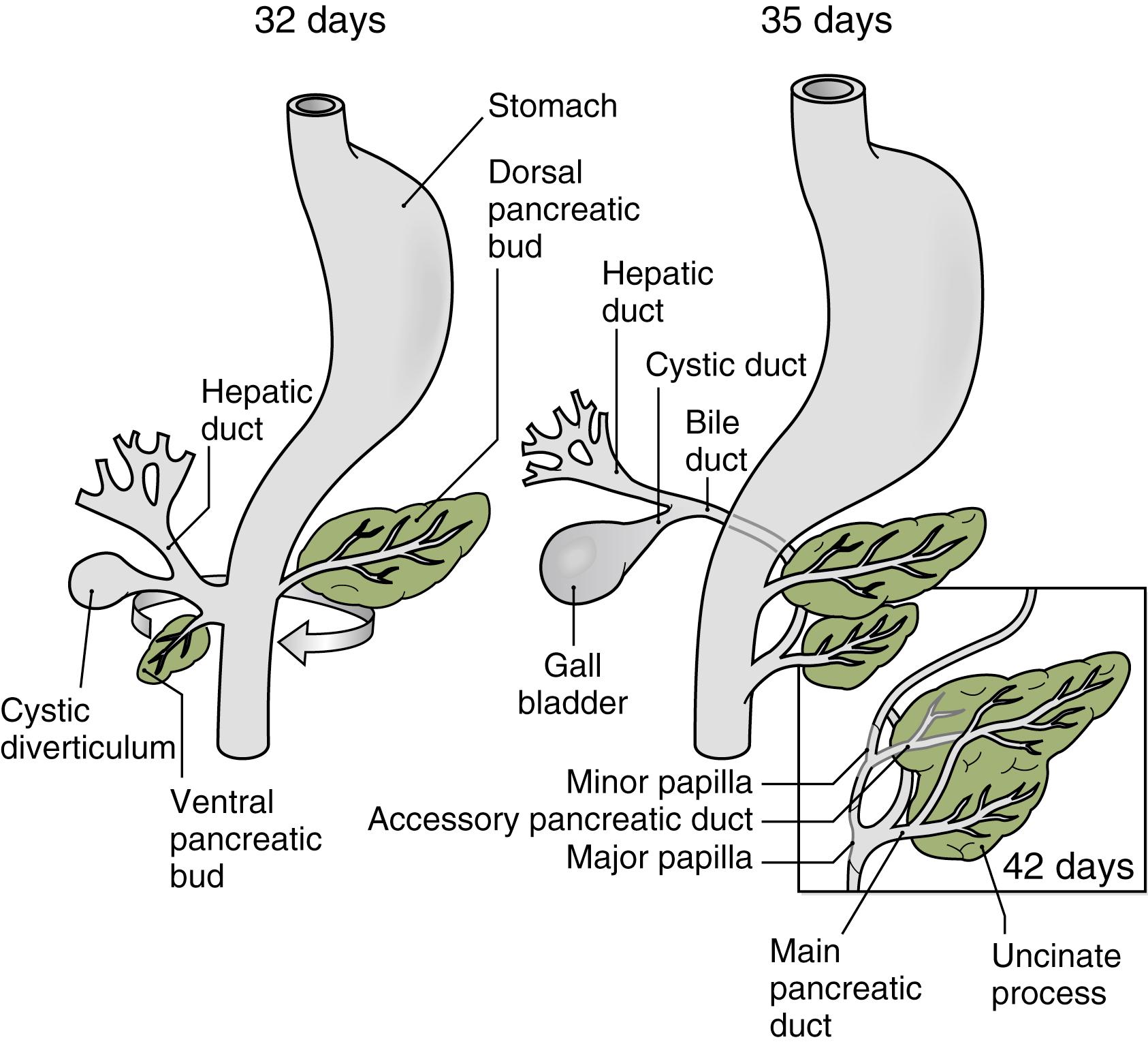 Fig. 80.1, Development of the Pancreas and Its Duct Systems.