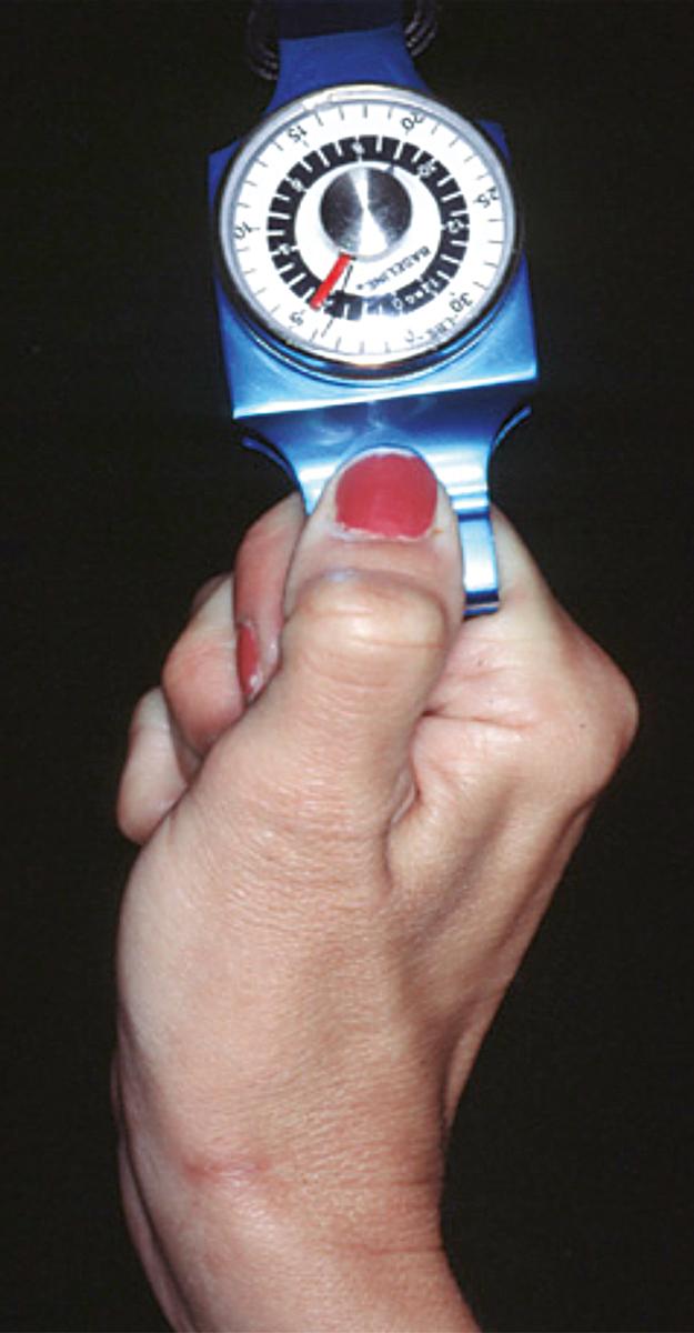 FIGURE 71.10, Jeanne sign (see text).