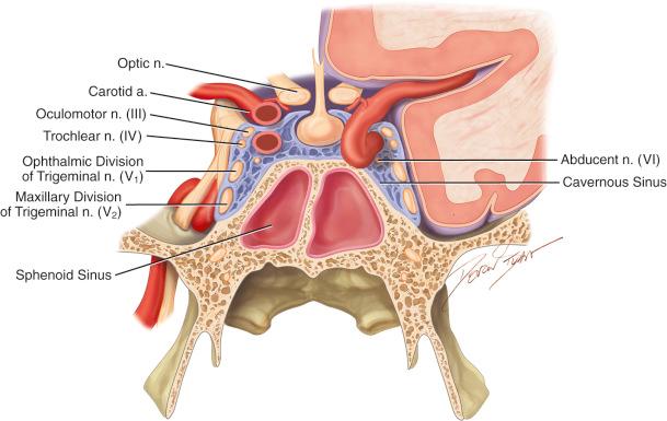 Figure 33.1, Anatomy of the sella and parasellar region.