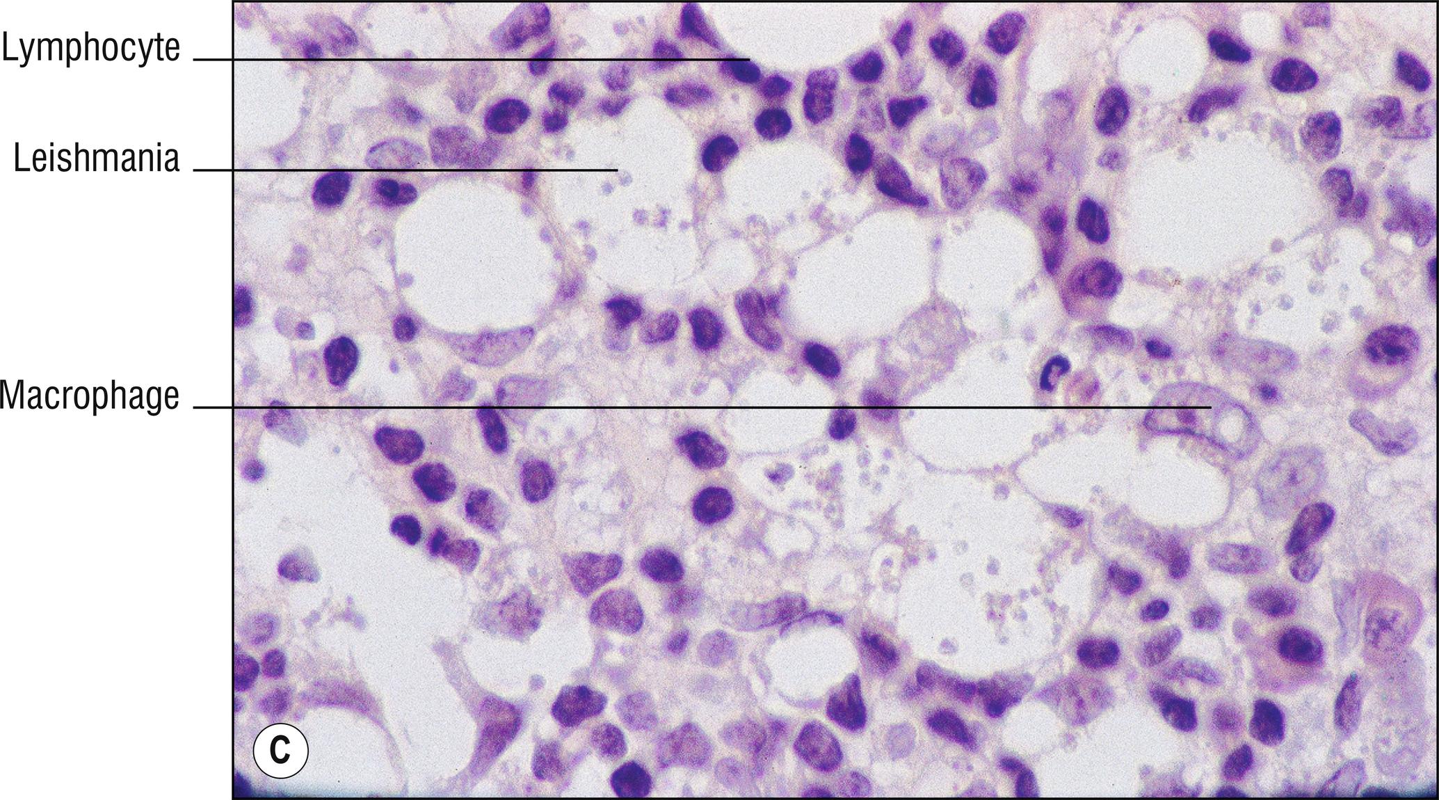 Fig. 15.1, C Leishmaniasis (high mag.).