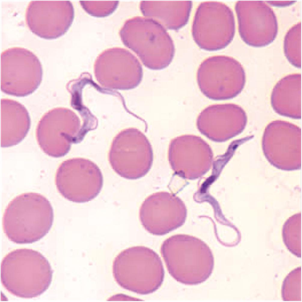 Figure 46-5, African trypanosomes in thin blood smear.