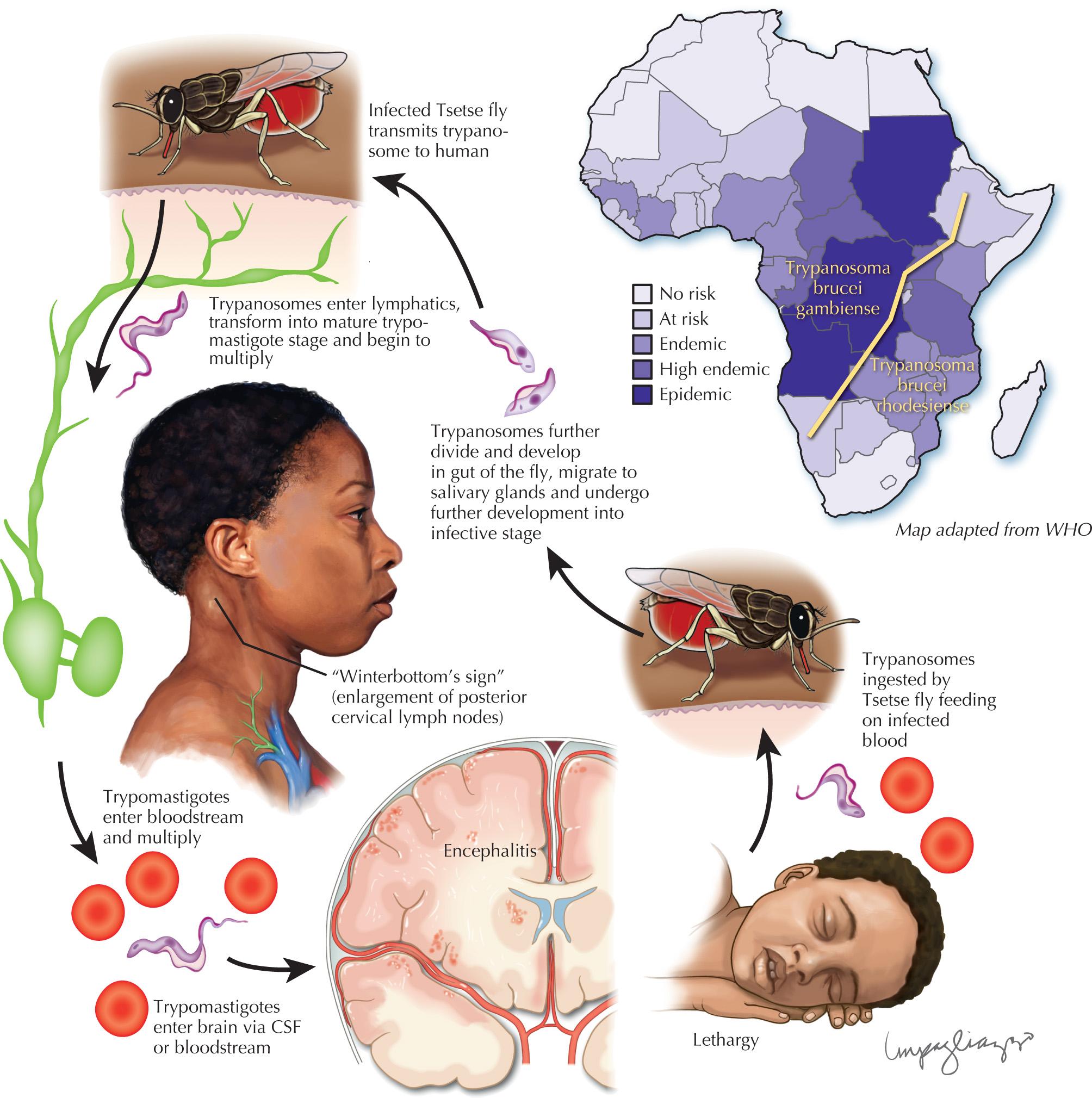 Fig. 46.3, Trypanosomiasis (African Sleeping Sickness).