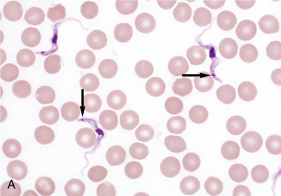 FIGURE 88.25, Trypomastigote stages of Trypanosoma brucei (A) and Trypanosoma cruzi (B) in peripheral blood (Giemsa, 1000×). The most reliable method for differentiating these two organisms is by examining the size of the kinetoplast (arrows), which is larger in T. cruzi .