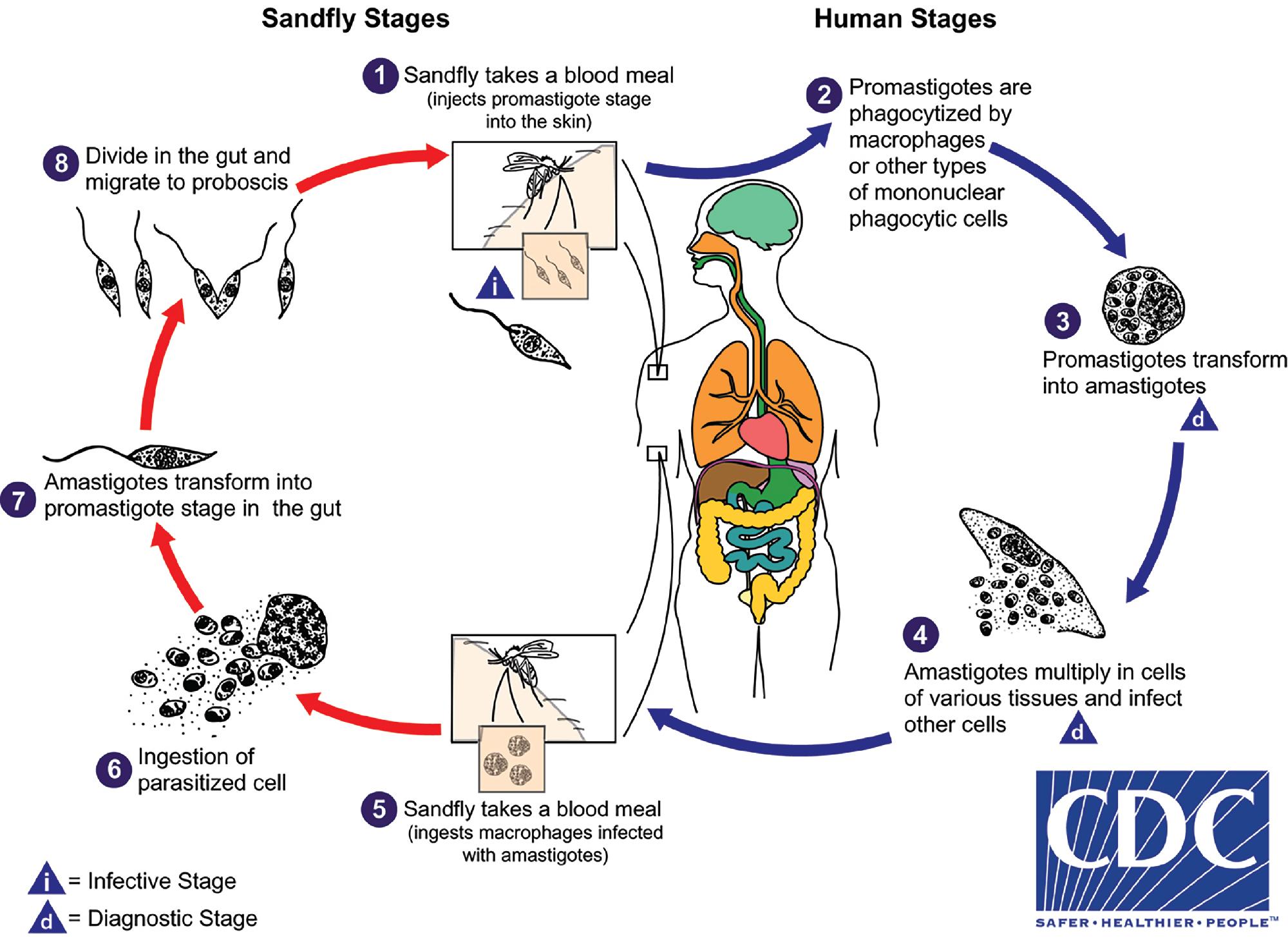 FIGURE 88.28, Life cycle of Leishmania spp. Humans become infected through the bite of an infected sandfly (1) , which injects infective promastigotes (i) into the skin while taking a blood meal. The promastigotes are immediately phagocytized by host macrophages (2) and transform into amotile amastigotes (3) . Depending on the Leishmania spp., infected macrophages may remain in the skin or localize to other organs, including the bone marrow, liver, spleen, and mucosal membranes. Amastigotes multiply by binary fission within macrophages (4) and may be taken up by a sandfly during a subsequent blood meal (5) . The parasites transform back into the promastigote form in the sandfly (6 to 8) . Amastigotes are the diagnostic form of infection (d) and may be seen in aspirates or biopsies of infected organs.