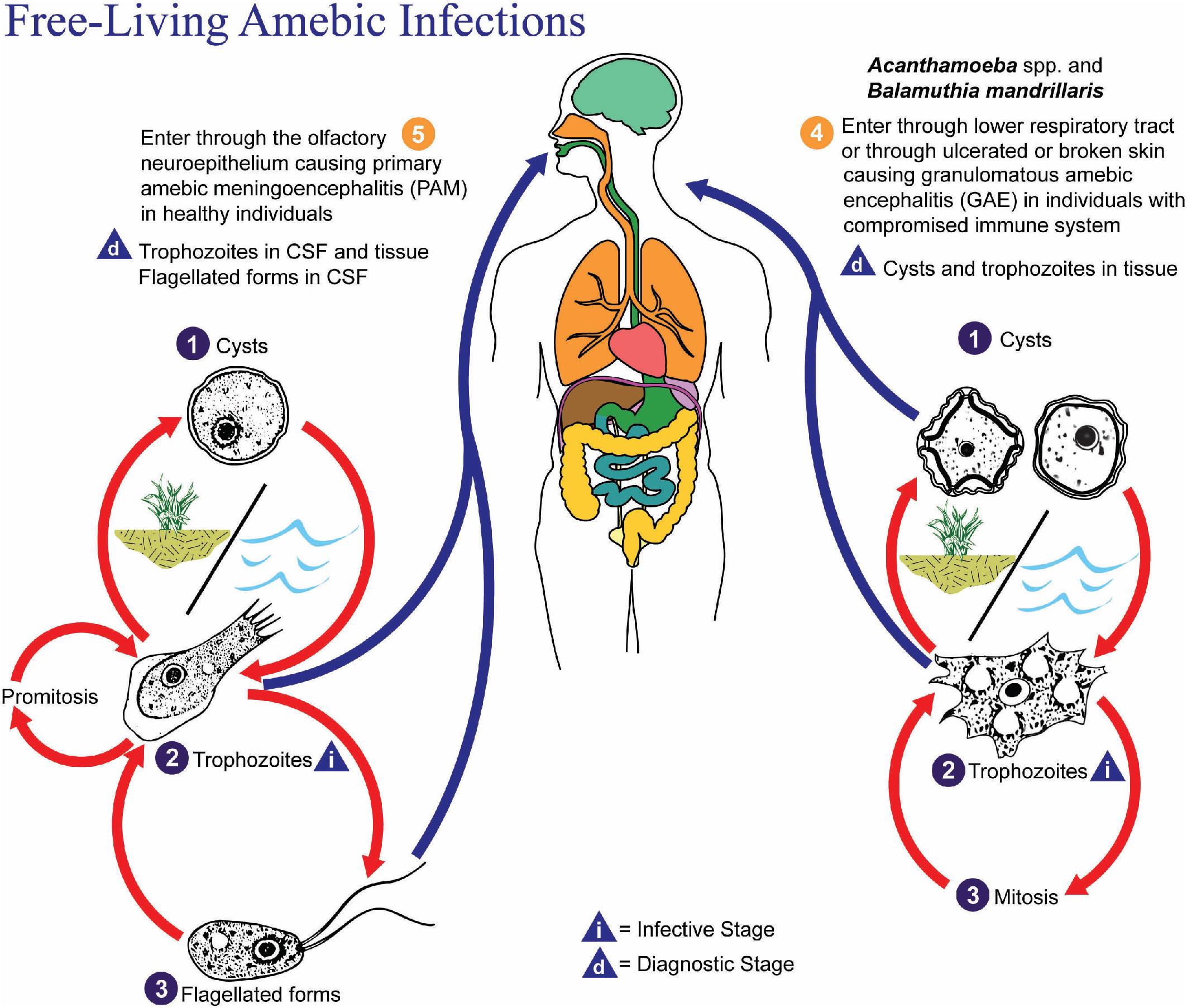 FIGURE 88.31, Life cycle of Naegleria fowleri, Acanthamoeba spp., and Balamuthia mandrillaris. These amebae normally live as free-living organisms in the environment and only rarely cause human disease. N. fowleri exists as cysts, trophozoites, and flagellated forms in the environment, while Acanthamoeba spp. and B. mandrillaris are found only as cysts and trophozoites (1 to 3) . Trophozoites of the latter two organisms (i) infect humans through inhalation or broken skin (4) and disseminate hematogenously to the central nervous system to cause granulomatous amebic encephalitis (GAE) . Acanthamoeba spp. can also enter the eye, particularly in contact lens wearers, and cause severe amebic keratitis (AK). Cysts and trophozoites are found in tissues in GAE and AK (d) . In comparison, N. fowleri trophozoites (i) enter the body through the nose and penetrate the nasal mucosa (5) . The parasites then travel along the olfactory nerves to the central nervous system, causing primary amebic meningoencephalitis (PAM) . Trophozoites can be seen in the cerebrospinal fluid (CSF) and brain, while, less commonly, flagellated forms can be seen in the CSF (d) .