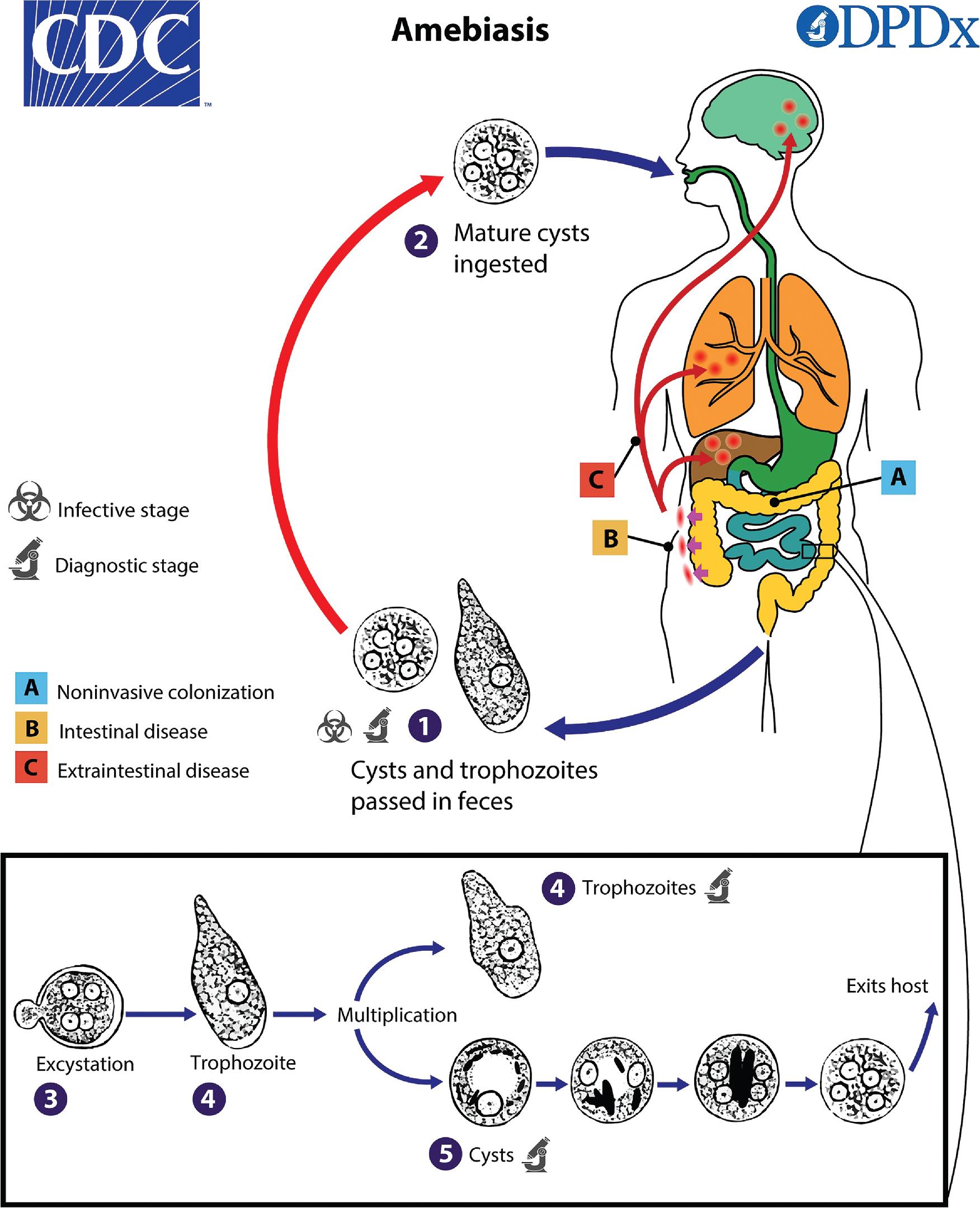 FIGURE 88.39, Life cycle of Entamoeba histolytica. Both cyst and trophozoite forms can be passed in the feces (1) and may be detected using direct, concentrated, and permanently stained stool preparations. Cysts are the infective stage and can lead to subsequent infection when ingested in contaminated food or water (2) . Excystation (3) occurs in the small intestine and can result in noninvasive colonization (A) , invasive intestinal disease (B) , and even extraintestinal dissemination (C) involving the liver (most commonly), lungs, brain, and other organs. Trophozoites divide by binary fission (4) . In the intestine, some trophozoites will undergo encystation (5) to form a cyst with one to four nuclei. The other intestinal amebae have a similar life cycle, but without an invasive or extraintestinal stage.