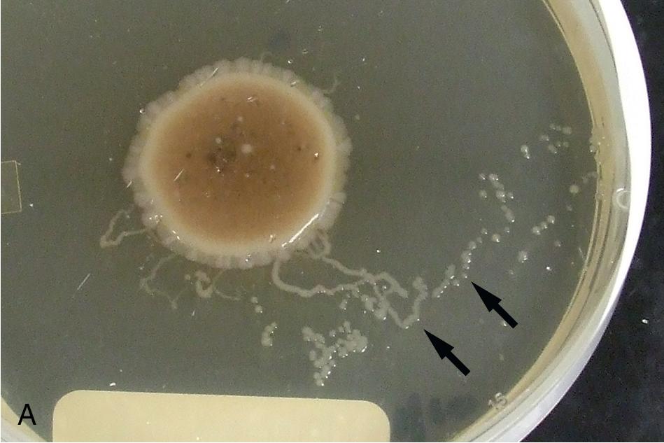 FIGURE 88.7, Stool agar culture method showing bacterial tracks (A, arrows ) formed by migrating Strongyloides stercoralis larvae. Examination of the plate using a light microscope reveals multiple larvae and detail of the agar tracks (B, unstained, 100×).