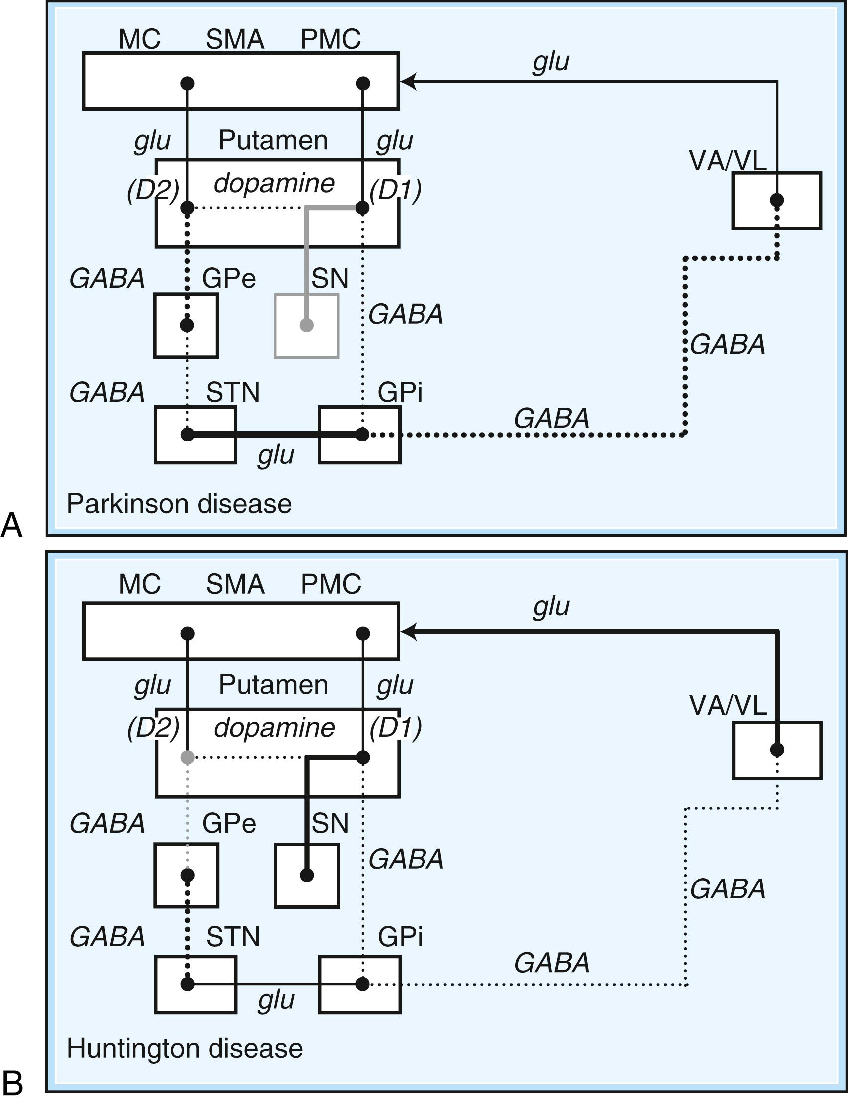 Fig. 96.3, Schematic drawing of functional activities in the direct and indirect pathways in Parkinson disease (PD) and Huntington disease (HD). A, In PD, reduced dopaminergic facilitation of direct pathway and inhibition of indirect pathway due to death of dopaminergic neurons causes increased firing and increased inhibition of thalamocortical pathways, producing bradykinesia. B, In HD, loss of striatal neurons leads to reduced activity in indirect pathway, causing reduced inhibition of thalamocortical pathways, with production of excessive or involuntary movements. (See Fig. 96.2 for explanations to abbreviations.) D 1 , Dopamine D 1 receptor; D 2 , dopamine D 2 receptor; GABA , γ-aminobutyric acid; glu , glutamate; GPe , external segment of the globus pallidus; GPi , internal segment of the globus pallidus; MC , motor cortex; PMC , premotor cortex; SMA , supplementary motor area; SN , substantia nigra; STN , subthalamic nucleus; VA/VL , ventral anterior/ventrolateral thalamic nuclei.