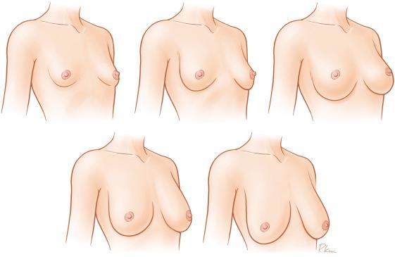 Fig. 16.1, Breast defects.