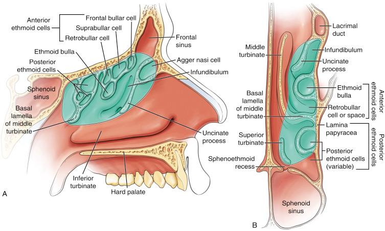 Fig. 7.2, Schematic drawings of the ethmoid sinuses showing sagittal (A) and axial (B) views of the structures involved in a complete ethmoidectomy (shaded area).