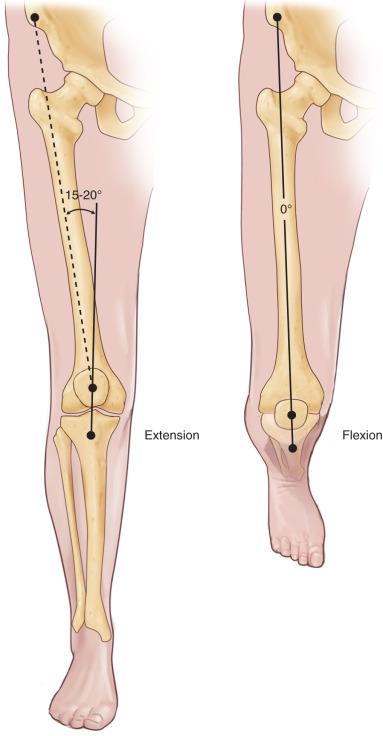 Fig. 106.5, Flexion of the knee decreases the Q angle as the result of internal tibial rotation.