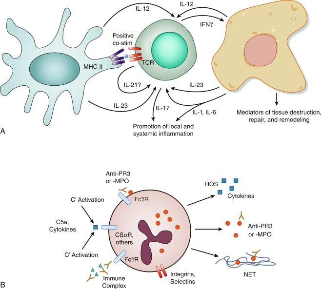 Fig. 10.1, (A) The key interactions between dendritic cells (left) , activated CD4 + T cells (middle), and macrophages (right) in the artery wall in giant cell arteritis. The balance of costimulatory and coinhibitory molecules turns to favor activation rather than inhibition (positive costimulation) when antigenic peptides bound to MHC class II molecules on antigen-presenting cells (APCs) are recognized by T cell receptors (TCR) . 25 IL-12 made by APCs favors development of Th1 T cells secreting IFN-γ. IL-23, IL-1β, IL-6, and IL-21 favor development of Th17 cells secreting IL-17, GM-CSF, and other proinflammatory cytokines. Macrophages, including giant cells, are a major source of enzymes and growth factors leading to tissue damage, repair, and remodeling. (B) Mechanisms of activation of neutrophils by immune complexes or ANCAs in small-vessel vasculitis. In both cases, Fc receptors, the receptor for C5a (C5aR), and likely other chemotactic factors and cytokines are involved, as are adhesion molecules. The exact order of activation through these receptors is unknown and may vary. Immune complexes may bind first to circulating cells, or the endothelium, or subendothelial tissues. ANCAs may bind to proteinase-3 or myeloperoxidase on the surface of neutrophils, the endothelium, in solution, and/or attached to neutrophil extracellular traps (NETs) . Neutrophil effector functions that could damage tissues and perpetuate inflammation include release of granule enzymes, cytokines and other mediators, reactive oxygen species (ROS) , and NETs. Not shown in (A) and (B) is the initial development of antigen-specific T cells and APCs, which are presumed to occur in lymphoid organs. ANCAs , Antineutrophil cytoplasmic antibodies; MPO , myeloperoxidase.