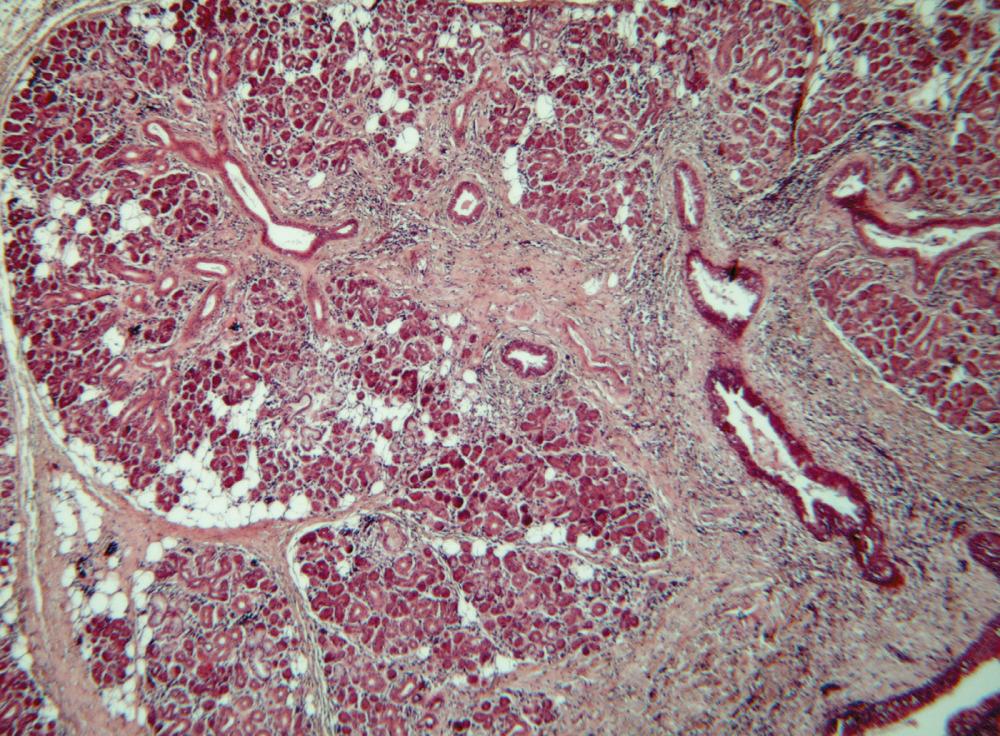 Fig. 10.1, Chronic submandibular sialadenitis with moderate inflammation, atrophy, and fibrosis. (H&E, ×33)