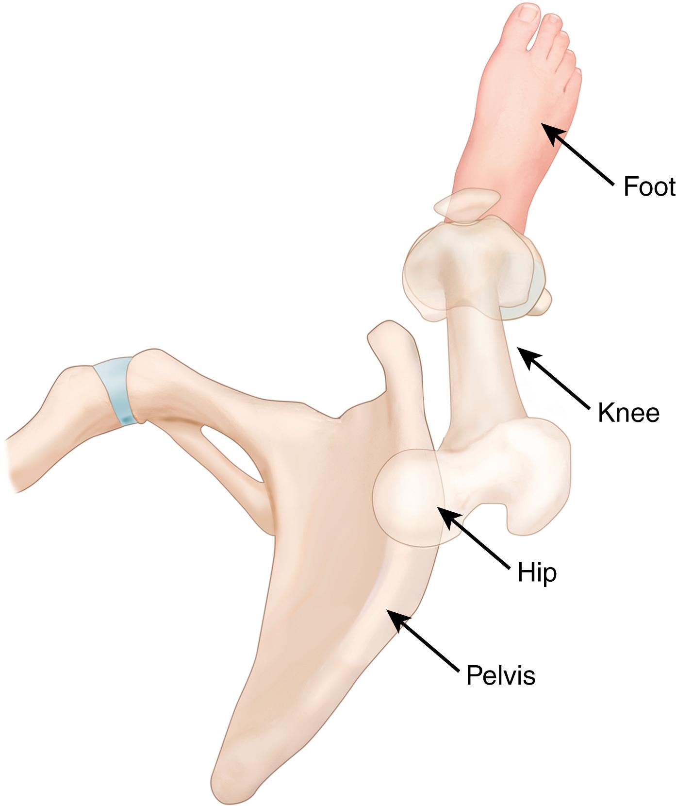 Fig. 29.2, A limb in the horizontal plane in a normal male patient with 13 degrees of femoral anteversion and 21 degrees of external tibial torsion and with the foot progression angle of 15 degrees contrasting greatly with the miserable malalignment depicted in Fig. 29.1. The knee joint is pointed very slightly outward or nearly straight ahead.