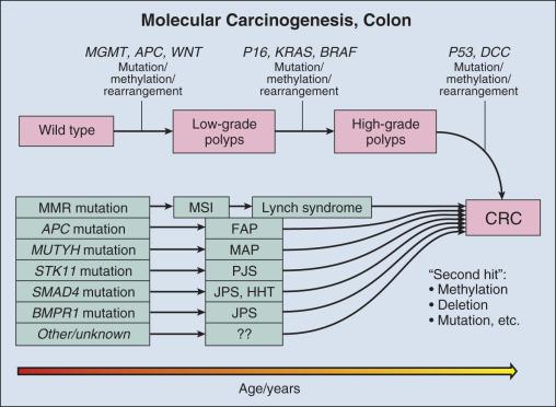 Figure 15.4, Accumulation of molecular changes that precede colorectal carcinoma (CRC). Sporadic tumors are initiated by a serial accumulation of somatic mutations that may eventuate in CRC. The initiating event in these polyposes is the mutation present at birth. Second hits may include a variety molecular changes including tumor suppressor gene promoter methylation, mutations, and copy number changes. Mismatch repair (MMR) and includes hMLH1, hMLH2, hMSH2, hPMS2, and EpCAMP genes. FAP, Familial adenomatous polyposis; HHT, hereditary hemorrhagic telangiectasia; JPS, juvenile polyposis syndrome; MAP, MUTYH- associated polyposis; MSI, microsatellite instability; PJS, Peutz-Jeghers syndrome.