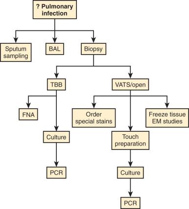 Figure 8.1, Approach to the handling of lung biopsies. BAL, Bronchoalveolar lavag; EM, electron microscopy; FNA, fine needle aspiration; PCR, polymerase chain reaction; TBB, transbronchial biopsy; VATS, video-assisted thoracoscopic surgical.