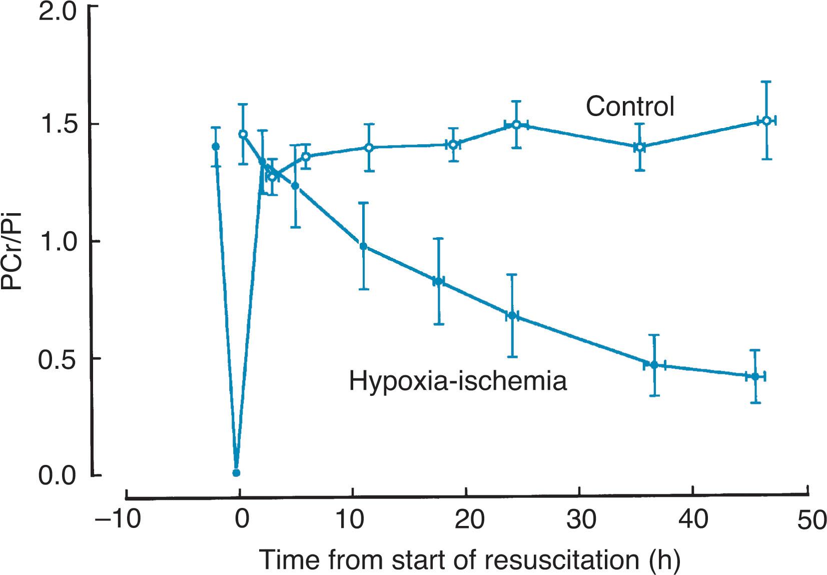 Fig. 16.17, High-energy phosphate levels in hypoxia-ischemia in brain of neonatal piglets. Note the sharp decline with the insult, followed by a recovery to baseline in 2 to 3 hours. A few hours later, a second decline ensues and constitutes “secondary energy failure” (see text). PCr , Phosphocreatine; Pi , inorganic phosphate.