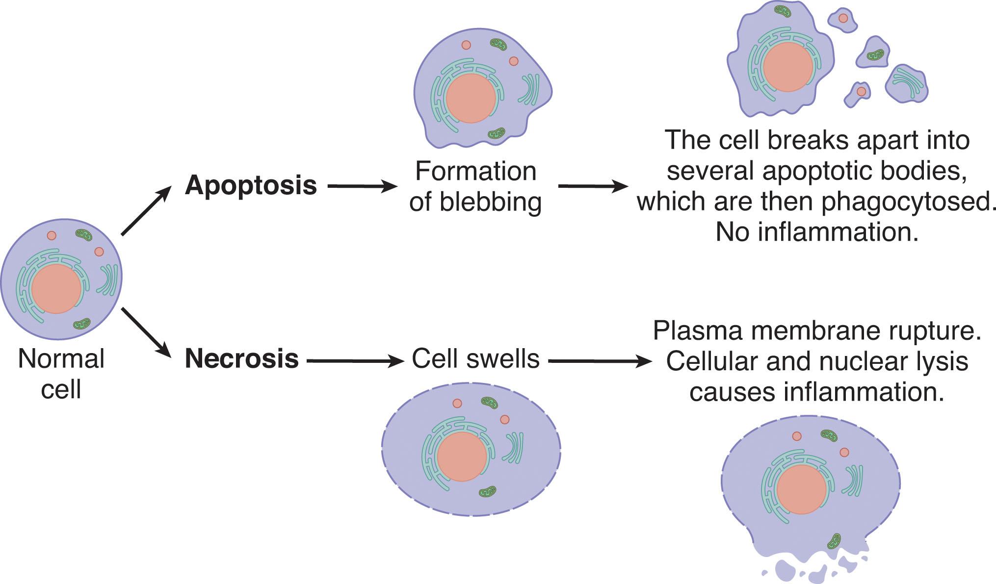 Fig. 16.7, Cellular histological images of necrotic and apoptotic cell death.
