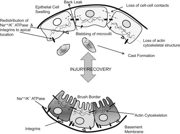 Figure 76.5, An overview of sublethal injury to tubular cells. An overview of sublethally injured tubular cells. Na/K/ATPase pumps are normally located at the basolateral membrane. In sublethal ischemia the pumps redistribute to the apical membrane of the proximal tubule. Upon reperfusion, the pumps reverse back to their basolateral location.