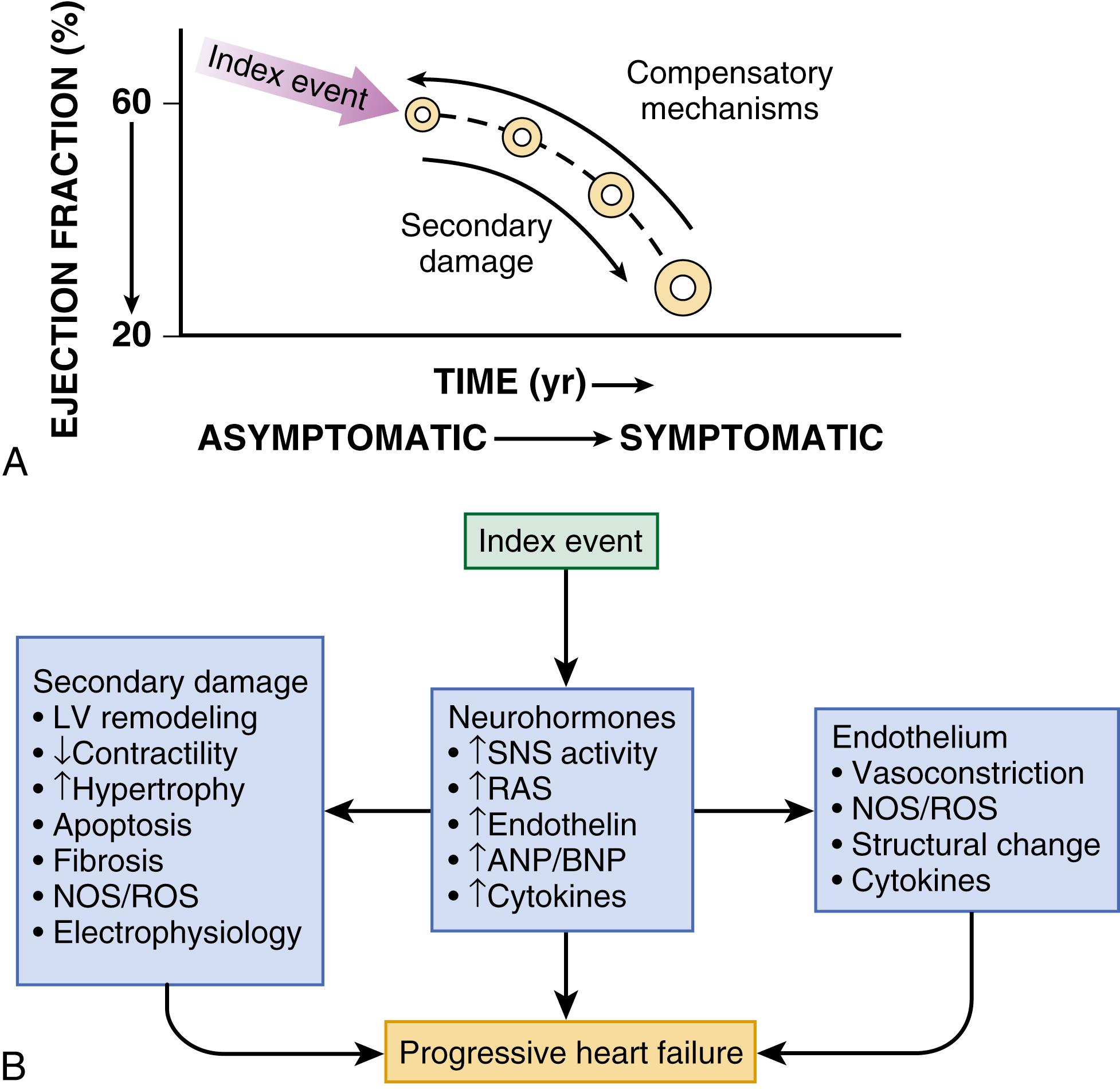 FIGURE 47.1, Pathogenesis of heart failure (HF). A, HF begins after a so-called index event produces an initial decline in pumping capacity of the heart. B, After this initial decline in pumping capacity, a variety of compensatory mechanisms are activated, including the adrenergic nervous system, the renin-angiotensin system (RAS), and the cytokine systems. In the short term, these systems are able to restore cardiovascular function to a normal homeostatic range, with the result that the patient remains asymptomatic. With time, however, the sustained activation of these systems can lead to secondary end-organ damage within the ventricle, with worsening LV remodeling and subsequent cardiac decompensation. As a result of these changes, patients undergo the transition from asymptomatic to symptomatic HF. ANP/BNP , Atrial/brain-type natriuretic peptide; NOS , nitric oxide synthase; ROS , reactive oxygen species; SNS, sympathetic nervous system.