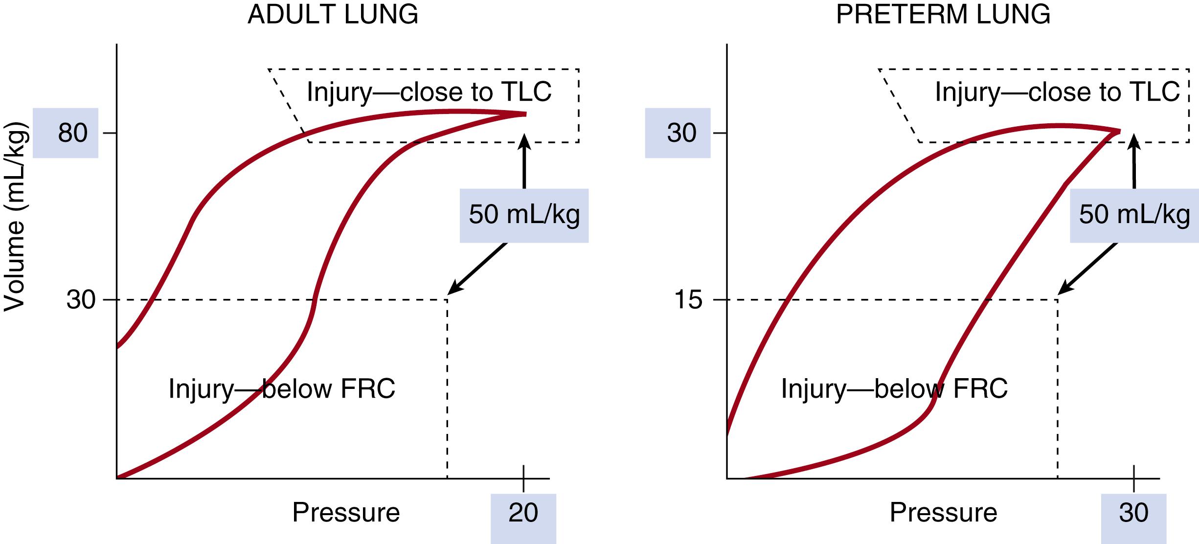 Fig. 157.6, Pressure-volume relationships for the lung with premature respiratory distress syndrome (RDS) and the adult lung. The preterm lung requires higher pressures to inflate to achieve a lower total lung capacity (TLC) than the adult lung. The premature lung also has a lower functional residual capacity (FRC) than the adult lung. The lung is likely to be injured if ventilation volumes are below FRC or encroach on TLC as indicated by the injury boxes.