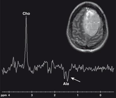 e-Figure 35.2, Magnetic resonance spectroscopy.