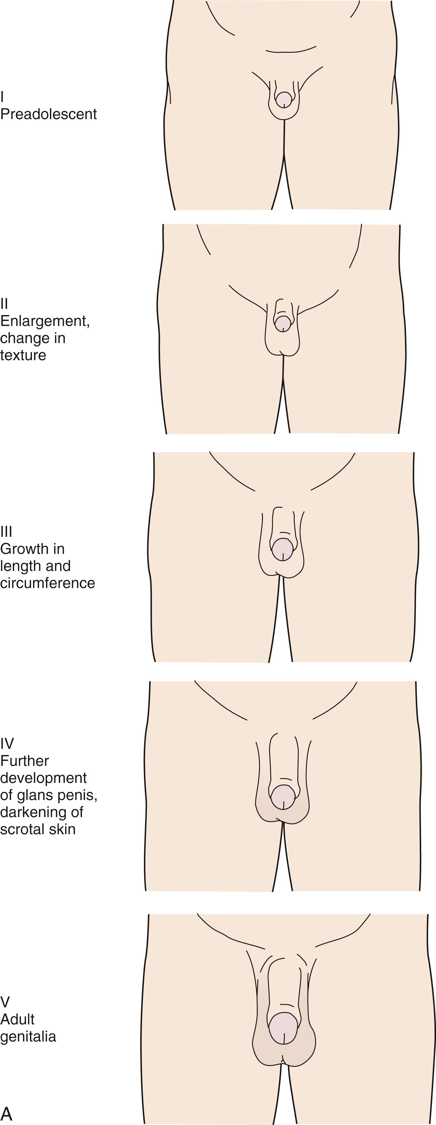 Fig. 9.4, Schematic drawings of male and female Tanner stages show male genital development (A), pubic hair development (B), and breast development (C).