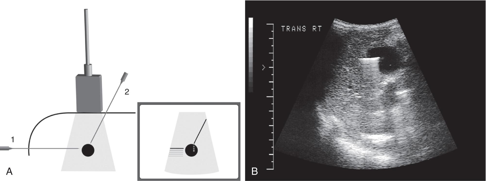 FIG. 56.2, Common Approaches.