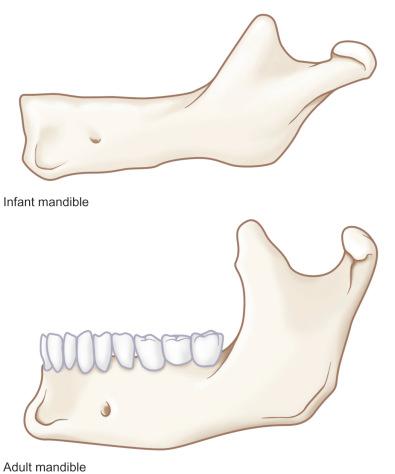 Fig. 2.5.1, Artist rendition of pediatric versus adult mandible.