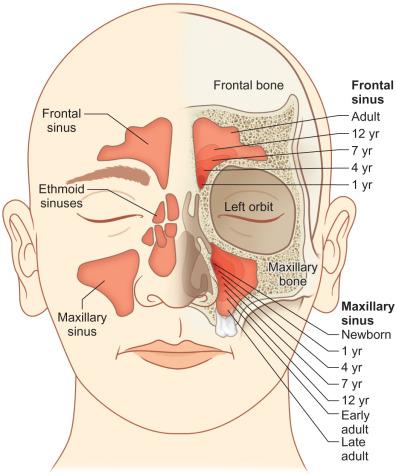 Fig. 2.4.2, Development of the sinuses in the facial skeleton.