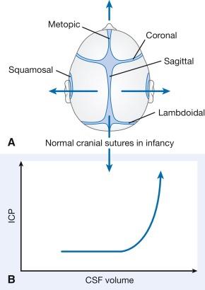 Fig. 20.4, Effect of cranial sutures and fontanel in neonates and infants. A, The open fontanelles and cranial sutures permit slow expansion of the intracranial volume. B, Initially the compliant skull of the neonate minimizes insidious increases in intracranial volume. However, acute increases in intracranial volume (hemorrhage and obstructed ventriculoperitoneal shunt) lead to rapid rises in intracranial pressure (ICP). CSF, cerebrospinal fluid.