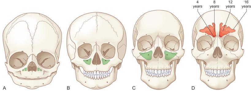 Fig. 2.3.1, Craniofacial development. Cranium to face ratio at birth (A) is 8 : 1 and evolves to 2.5 : 1 at adulthood (C). Maxillary sinus (green) progressive pneumatization at birth (A), at 5 years of age (B), and at adulthood (C). Frontal sinus (D) pneumatization.