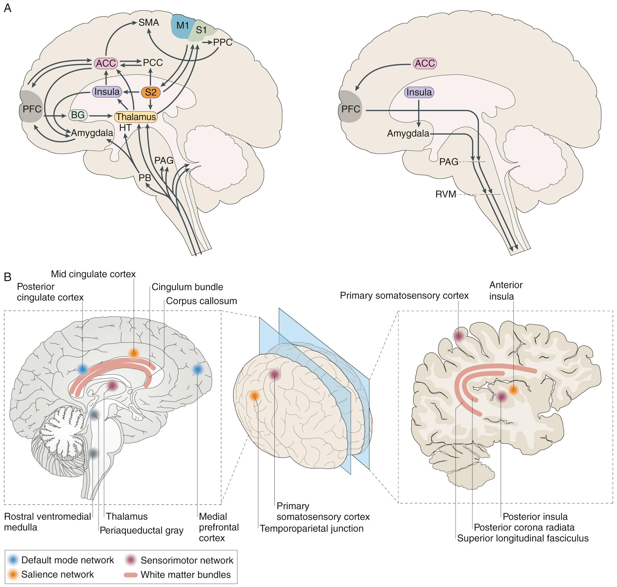 Fig. 76.1, Brain pathways, regions, and networks involved in acute and chronic pain.