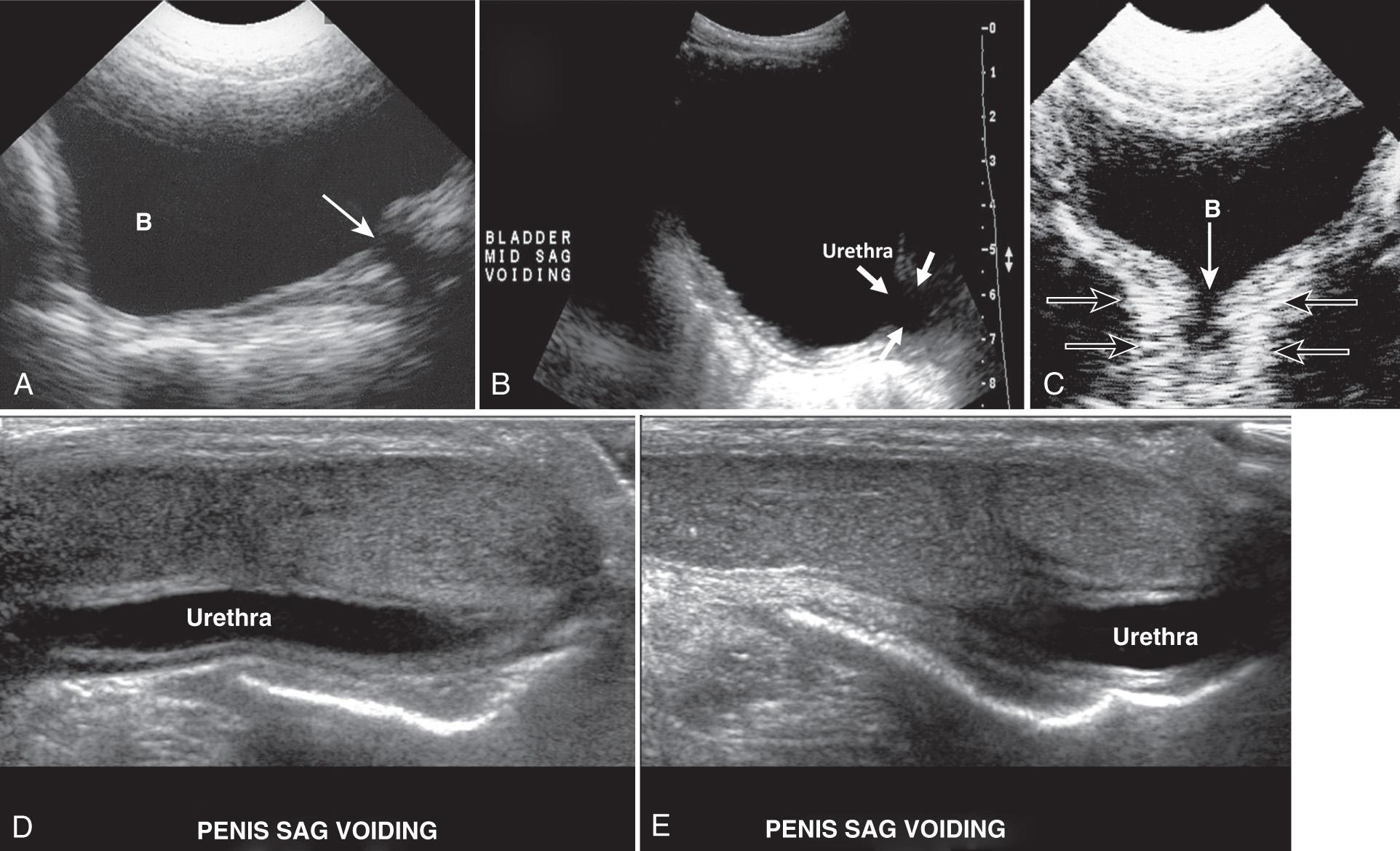 FIG. 54.4, Normal Urethras.