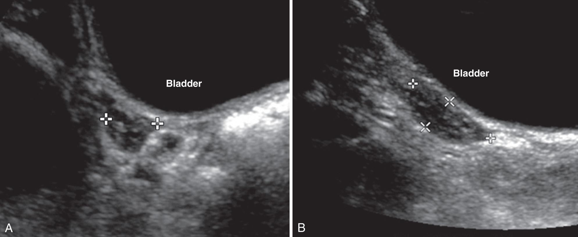 FIG. 54.7, Normal Ovary in 2-Year-Old Child.