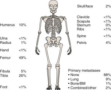 Fig. 80.2, Distribution of Primary Sites and Sites of Metastases in Osteosarcoma.