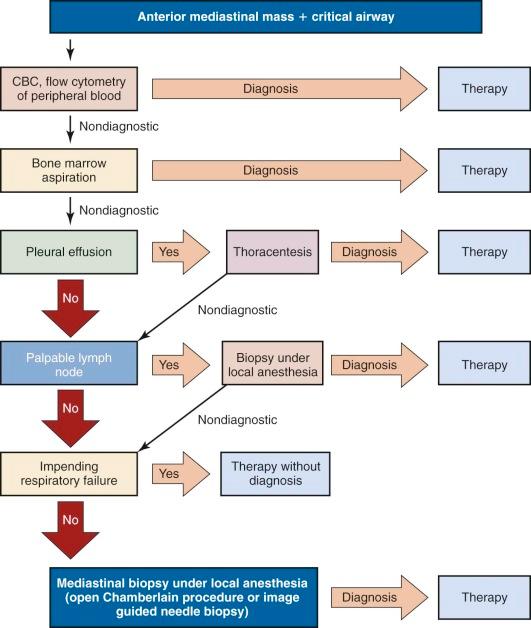 Figure 49-6, Algorithm for workup of patients with a critical airway resulting from compression by an anterior mediastinal mass. CBC, Complete blood count.