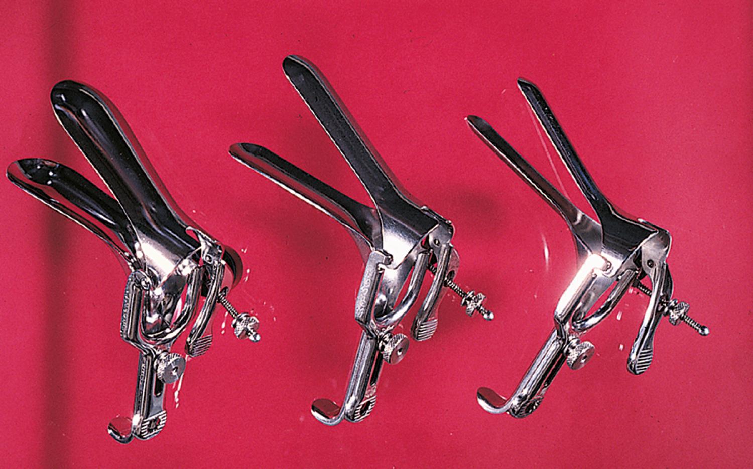 Fig. 19.7, From left to right: The Graves speculum is best reserved for large or gravid adolescents; the Pederson speculum is adequate for most sexually active adolescents; the narrow-bladed Huffman is preferred for virginal adolescents.