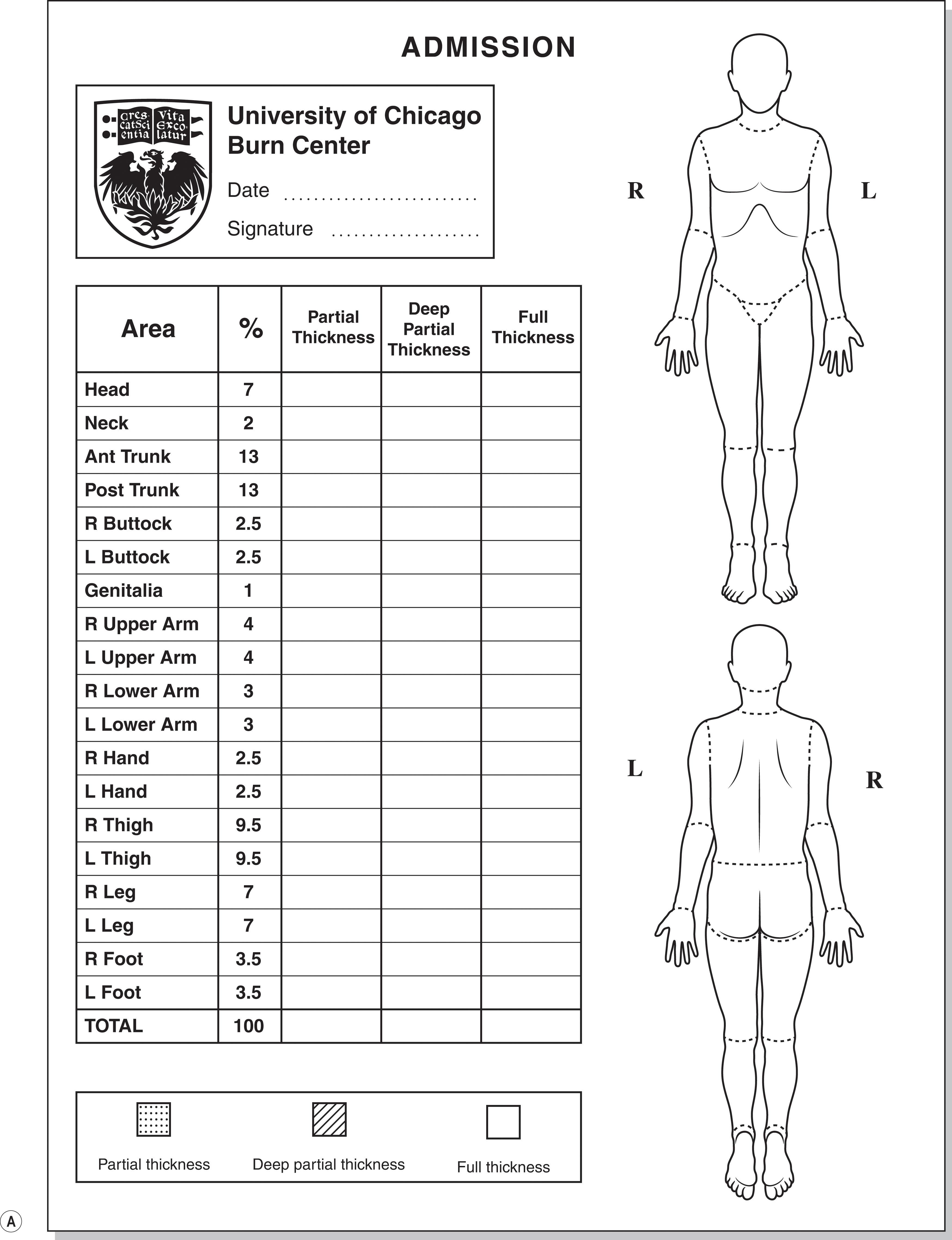 Figure 21.3, (A) Lund and Browder diagram, adult. ( B) Lund and Browder diagram, pediatric.