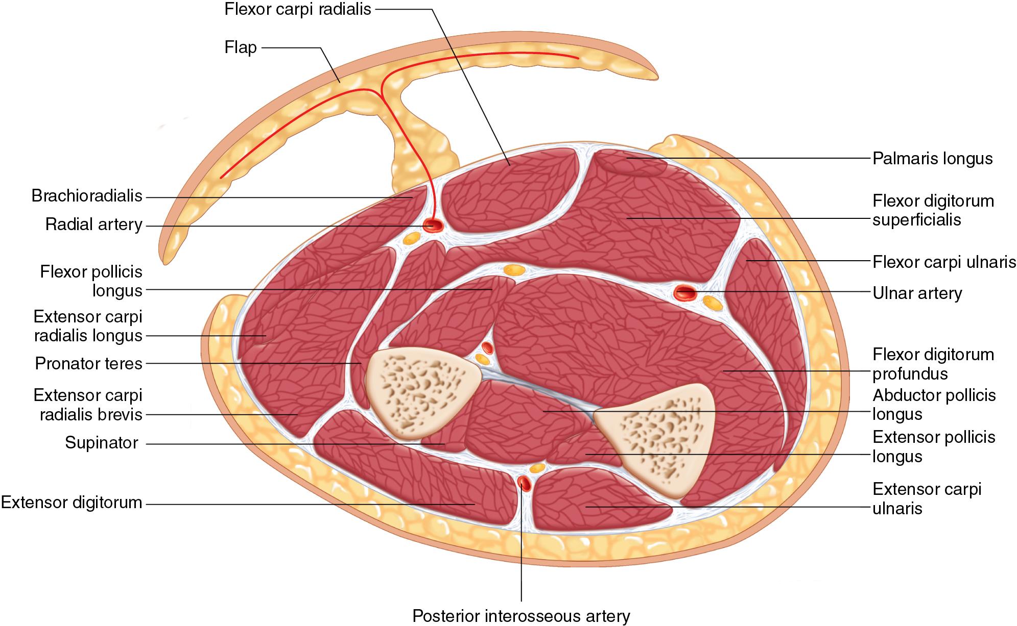 FIGURE 90.1