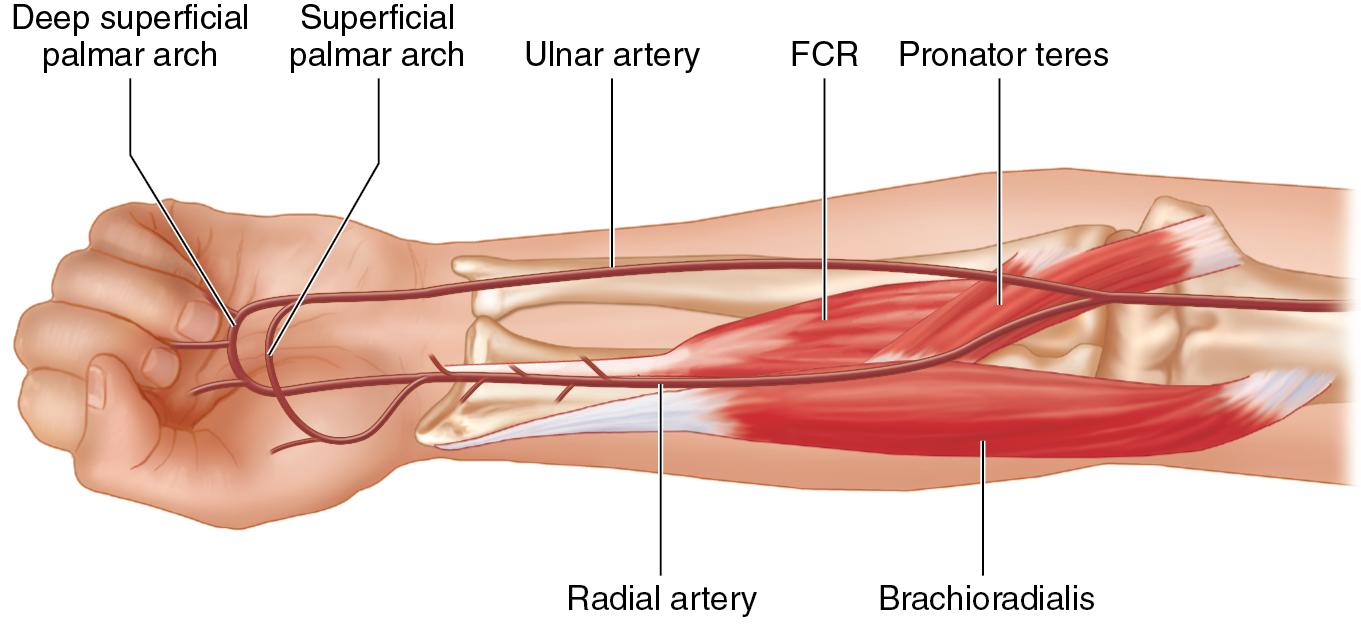 FIGURE 90.3