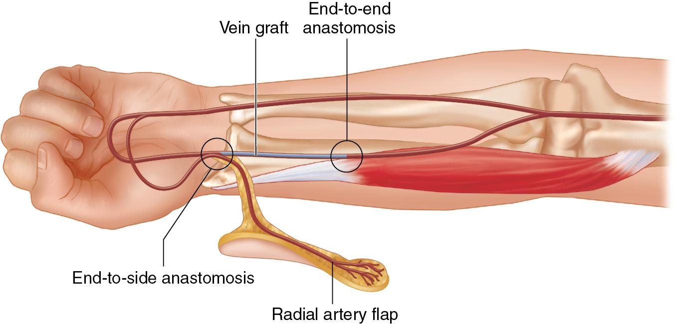 FIGURE 90.8