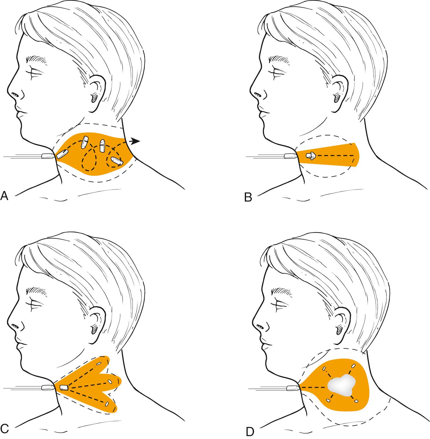 Fig. 120.2, Types of injuries caused by different missiles.