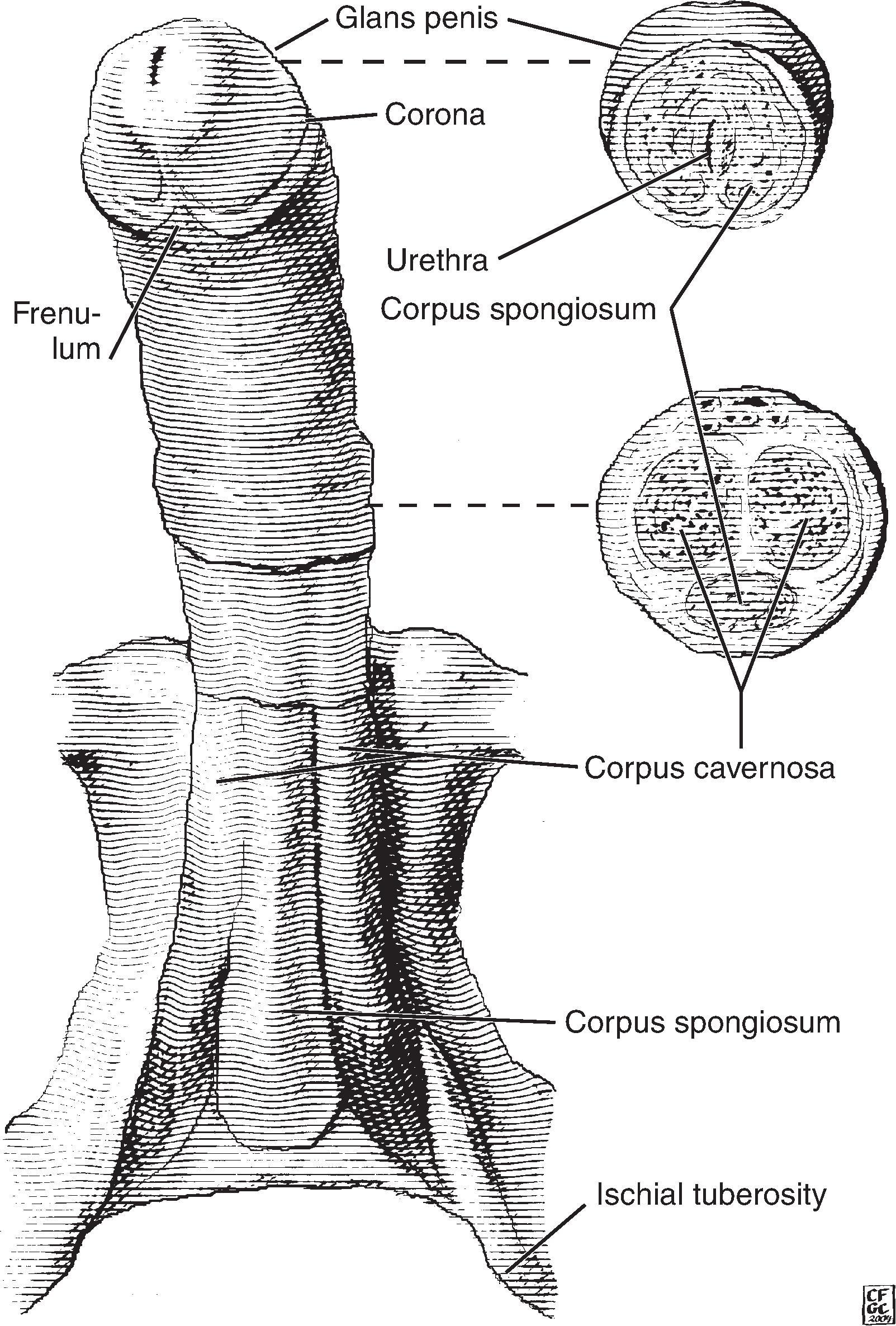 Figure 27.1, Penis anatomy.