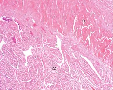 Fig. 15.2, Tunica albuginea (TA) and corpus cavernosum (CC) showing erectile tissue similar to corpus spongiosum, with a more muscular appearance.