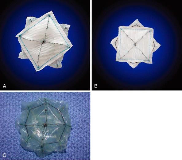 Fig. 49.4, Photographs of the CardioSeal (A), STARFlex (B), and BioSTAR (C) septal occluders. These devices are no longer available.