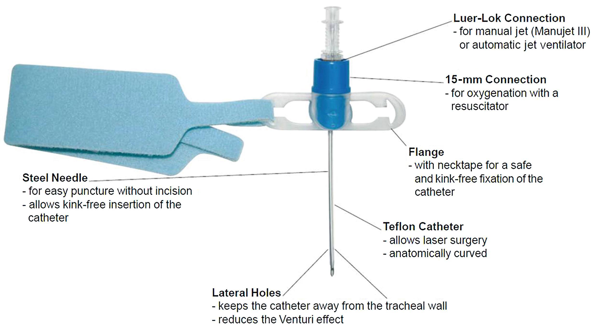 Fig. 28.2, Ravussin cannula. (Courtesy VBM Medical, Noblesville, IN.)